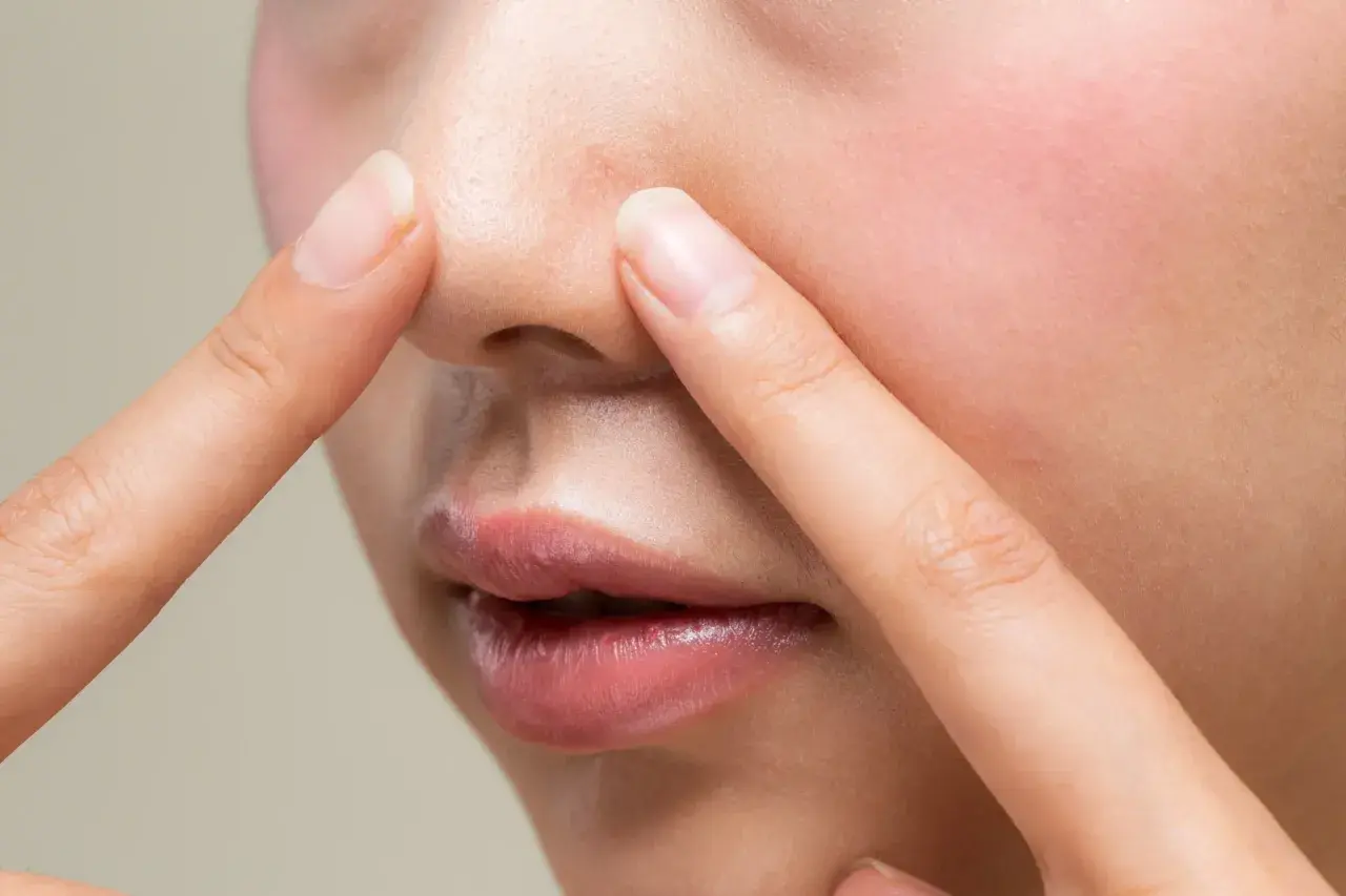 Dłonie dotykają nosa, ukazując pory i zaczerwienienie. Czy to nadmiar sebum?