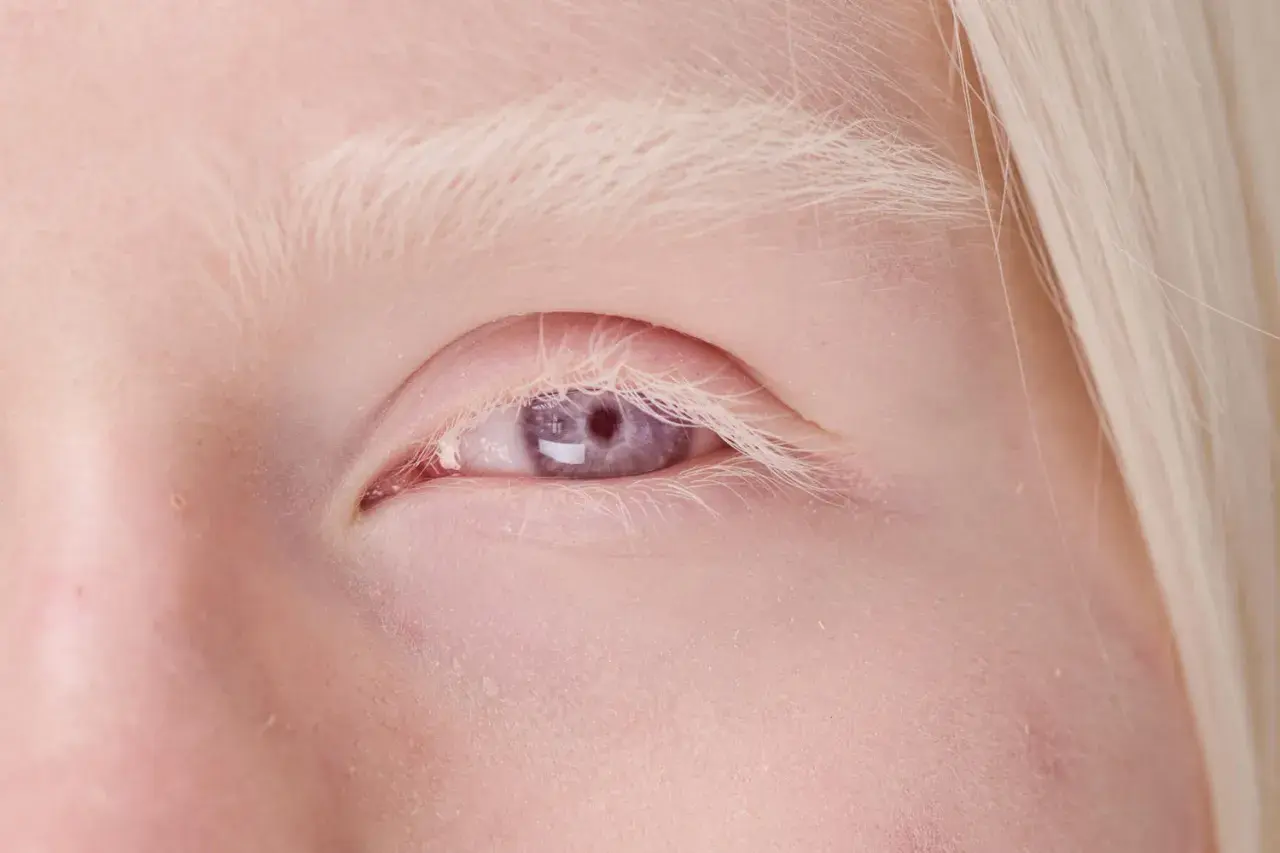 Blond włosy i jasna skóra otaczają piękne, fioletowo-szare oczy.