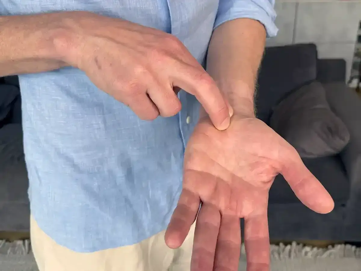 En man pekar på sin handled, som om han har ont i handled och fingrar.