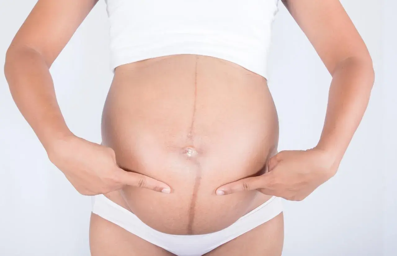 Ciężarna kobieta wskazuje palcami na ciemną linię biegnącą przez środek brzucha, zwaną linea negra.