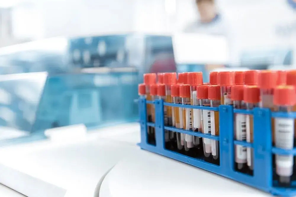 Badania hematologiczne: Co to jest i co mówią o Twoim zdrowiu?