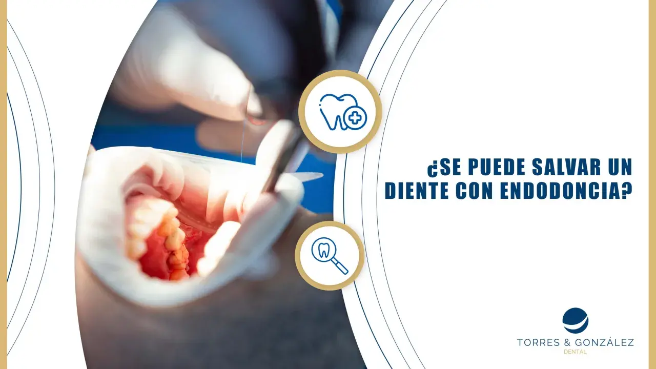 Procedimiento de endodoncia en un diente frontal. Dentista trabajando en la boca de un paciente.