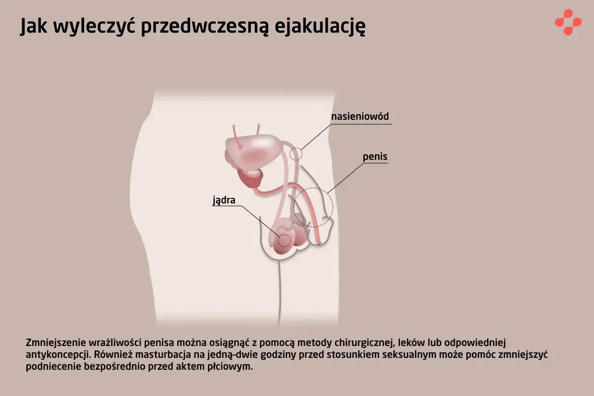Anatomia układu rozrodczego męskiego, ilustracja wyjaśniająca, jak można zaradzić niespodziewany wytrysk.