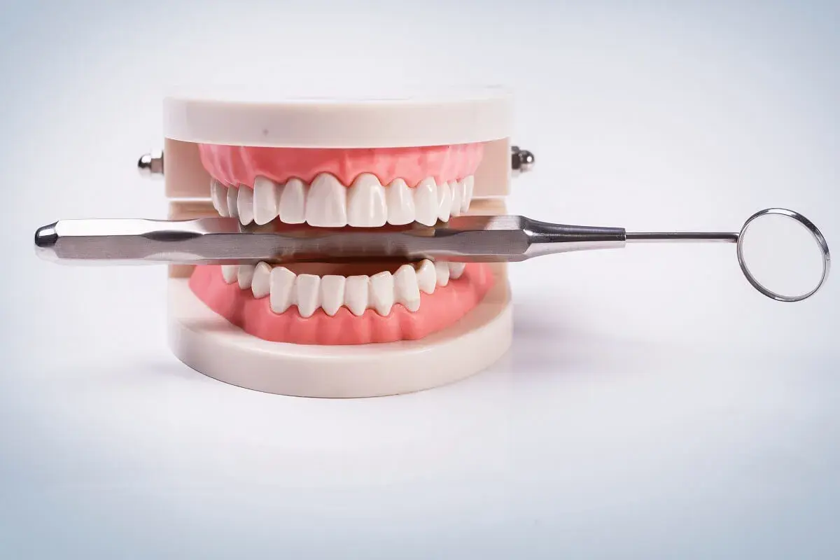 Model szczęki z narzędziem dentystycznym. Zastanawiasz się nad karierą? Sprawdź, jakie są technik dentystyczny zarobki.