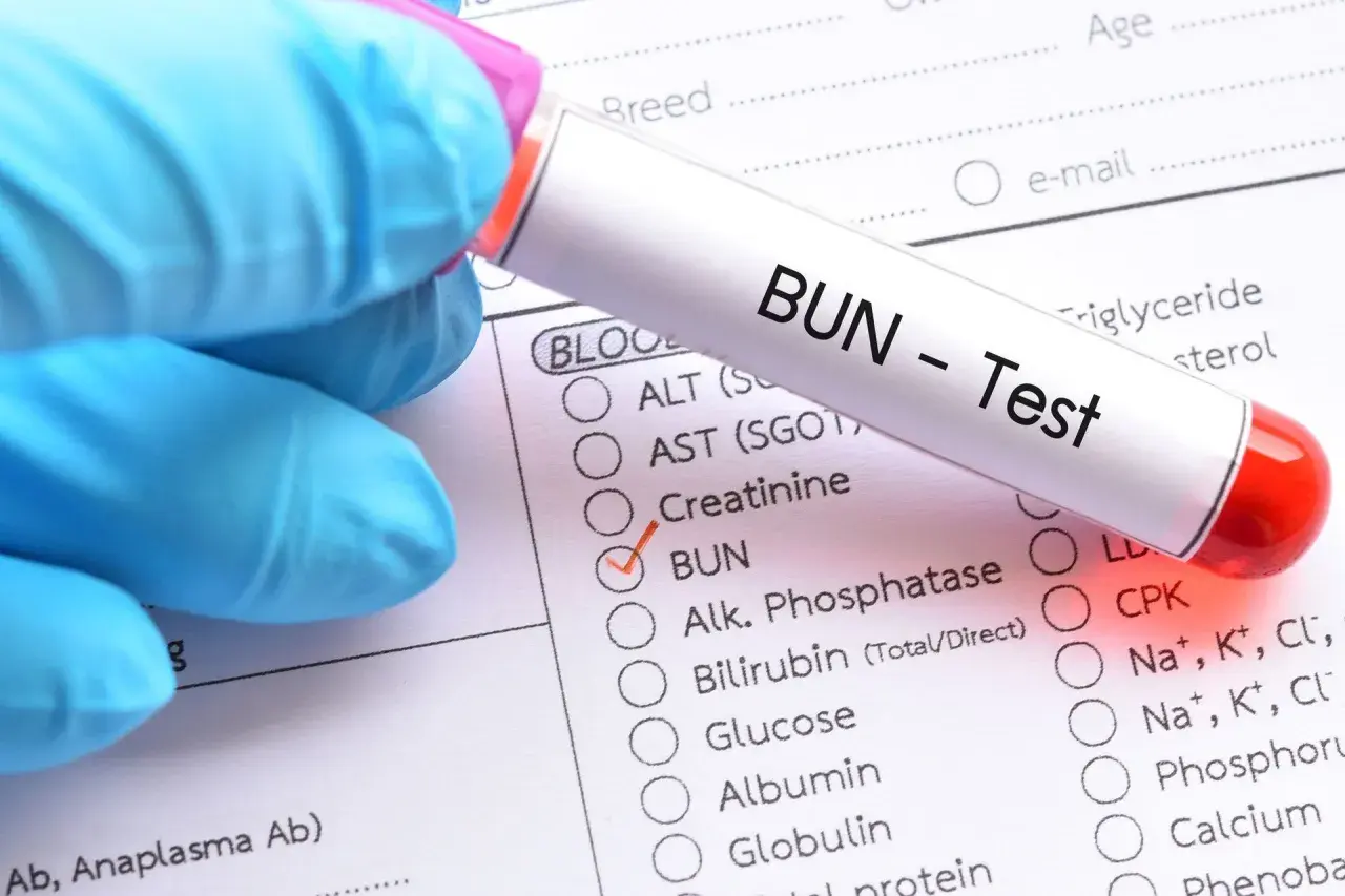 Rękawiczka w niebieskiej rękawiczce trzyma probówkę z napisem "BUN - Test". Zaznaczono opcję BUN, co oznacza badanie mocznika we krwi.