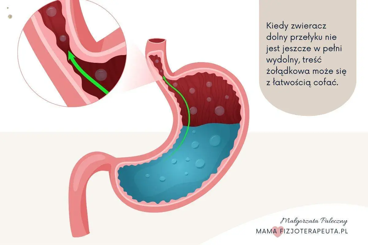 Ilustracja pokazuje żołądek i przełyk, gdzie treść żołądkowa cofa się do góry. To wyjaśnia problem refluksu u niemowlaka.