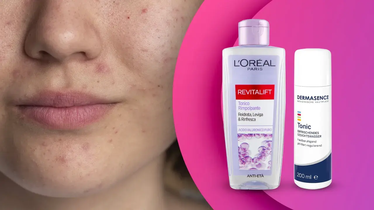 Viso con imperfezioni e due flaconi di tonico, uno L'Oréal Revitalift, l'altro Dermasence, per una pelle giovane e luminosa.