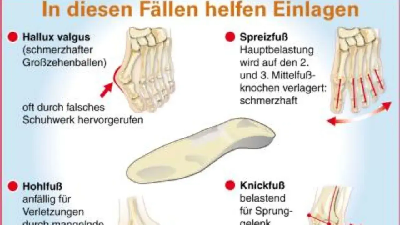 Weichpolstereinlagen helfen bei Hallux valgus, Spreizfuß, Hohlfuß und Knickfuß. Sie entlasten schmerzhafte Bereiche und beugen Verletzungen vor.