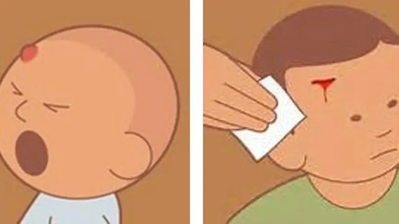 Bebé con chichón en la cabeza y niño con herida sangrante en la frente, mostrando un golpe en la cabeza niño.