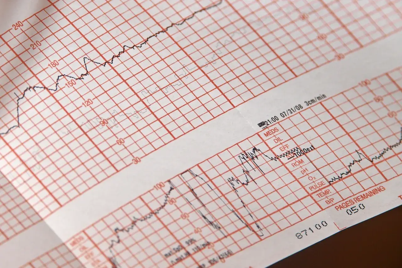 EKG: Przygotowanie krok po kroku. Pewny wynik bez obaw!