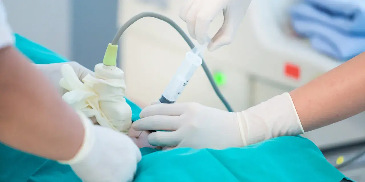 Mani guantate eseguono amniocentesi, un esame diagnostico che si fa solitamente tra la 15ª e la 20ª settimana di gravidanza.