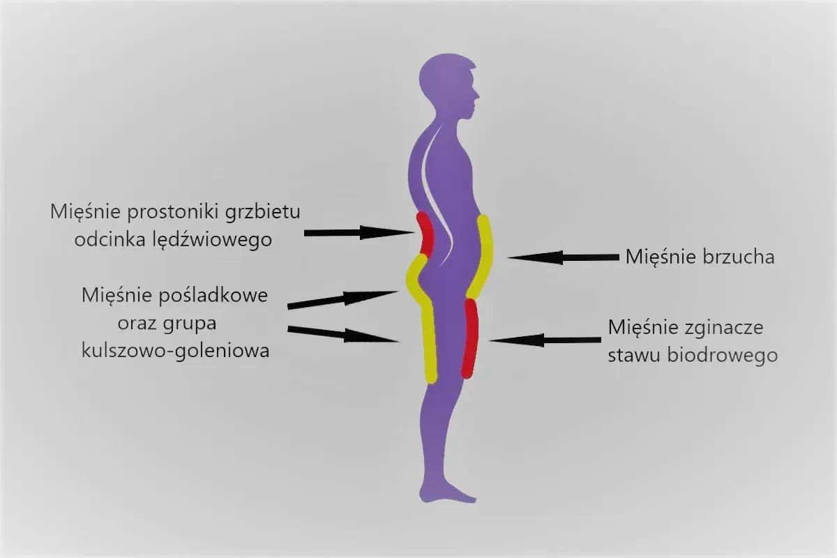 Schemat sylwetki z zaznaczonymi mięśniami. Widoczna pogłębiona lordoza lędźwiowa.