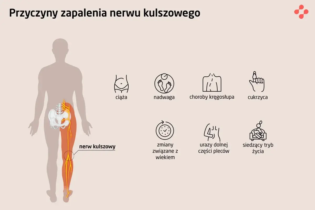 Ilustracja przedstawia przyczyny zapalenia nerwu kulszowego: ciążę, nadwagę, choroby kręgosłupa, cukrzycę, zmiany związane z wiekiem, urazy pleców i siedzący tryb życia.