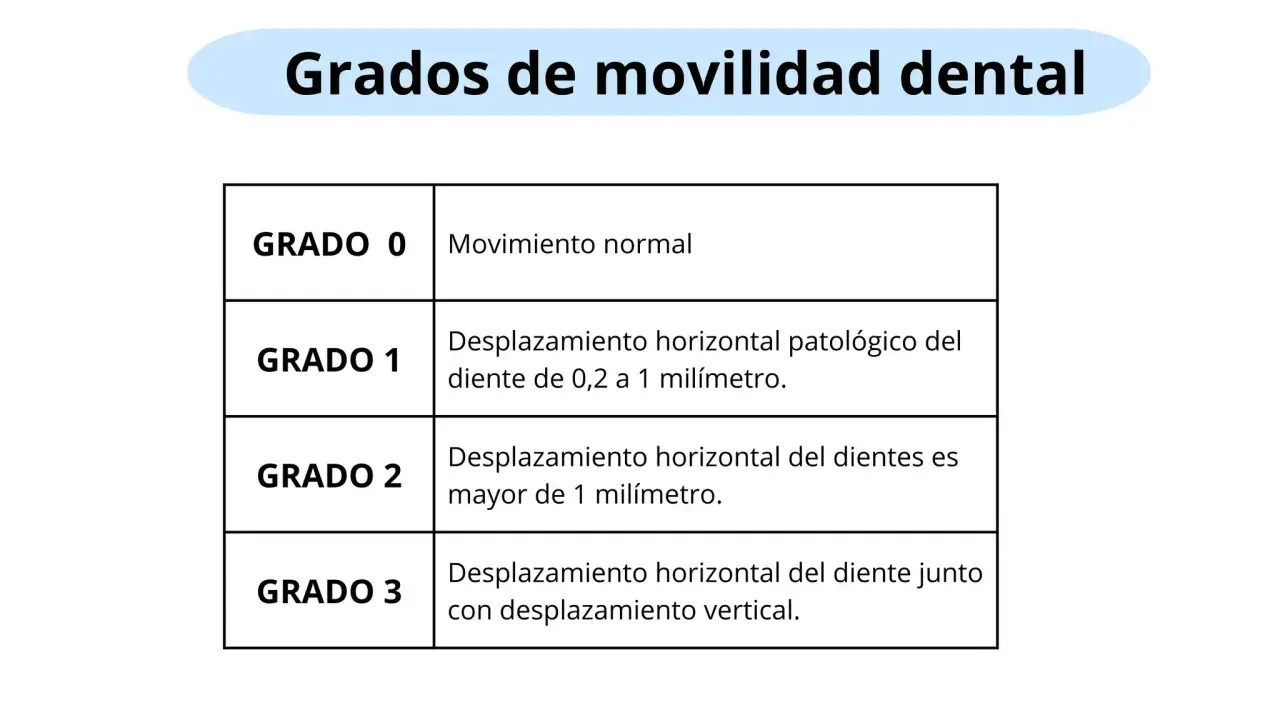 Tabla que clasifica los grados de movilidad dental: Grado 0 (normal), Grado 1 (desplazamiento horizontal patológico 0.2-1mm), Grado 2 (desplazamiento horizontal >1mm), Grado 3 (horizontal y vertical).