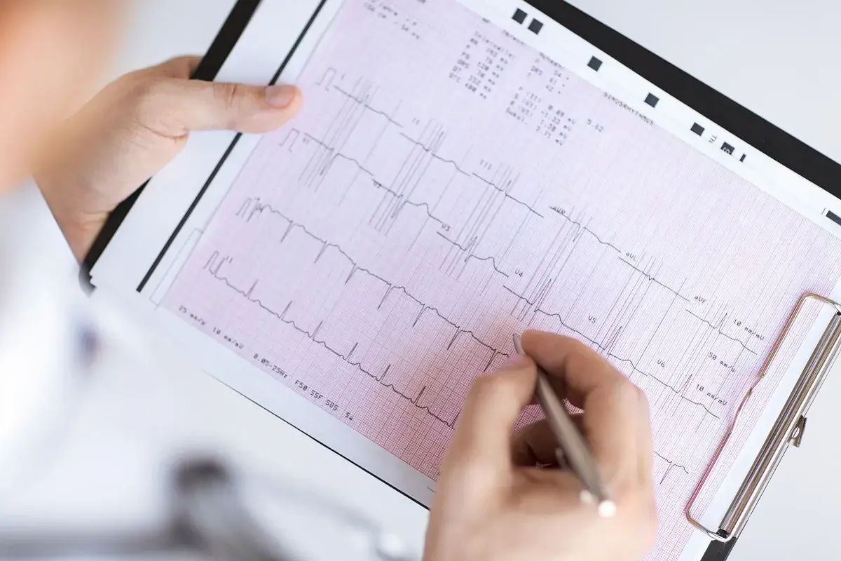 Ręka z długopisem wskazuje na zapis EKG, pomagając zrozumieć, jak odczytać wynik ekg.