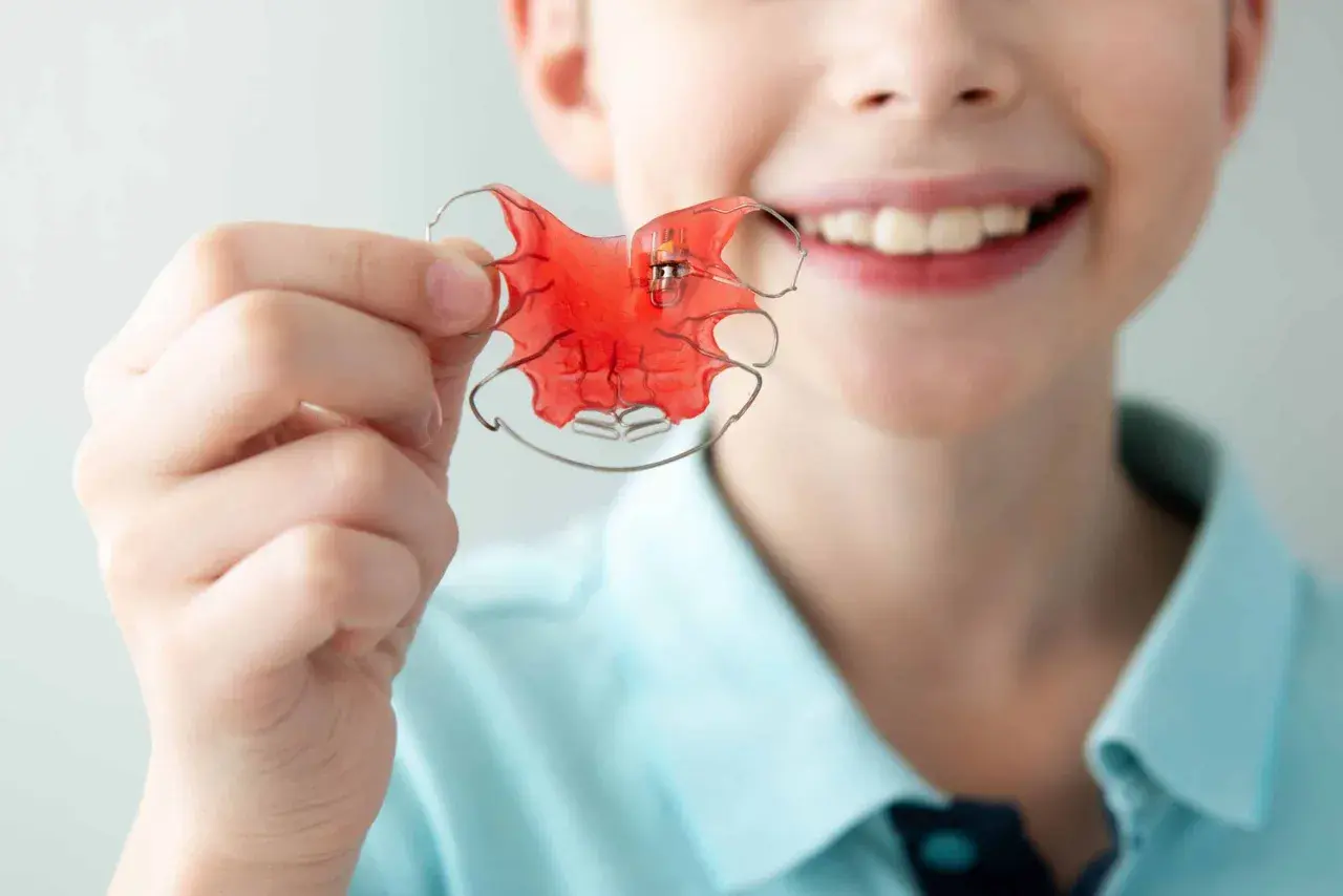 Niño sonriente muestra un aparato de ortodoncia rojo, un twin block, para corregir su mordida.