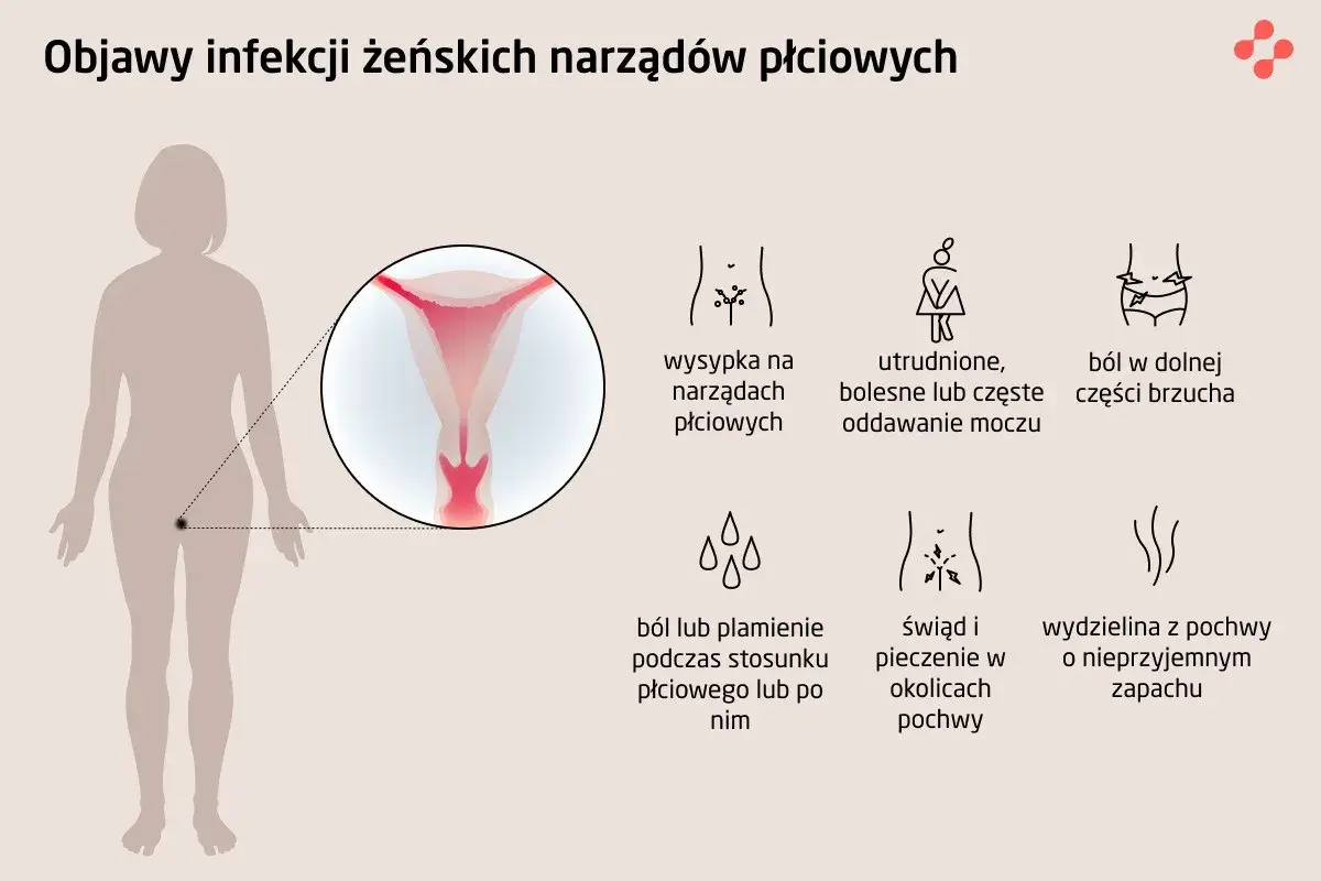 Objawy infekcji narządów płciowych: wysypka, ból brzucha, problemy z oddawaniem moczu, świąd, pieczenie, ból podczas seksu. Choroby weneryczne mogą objawiać się podobnie.