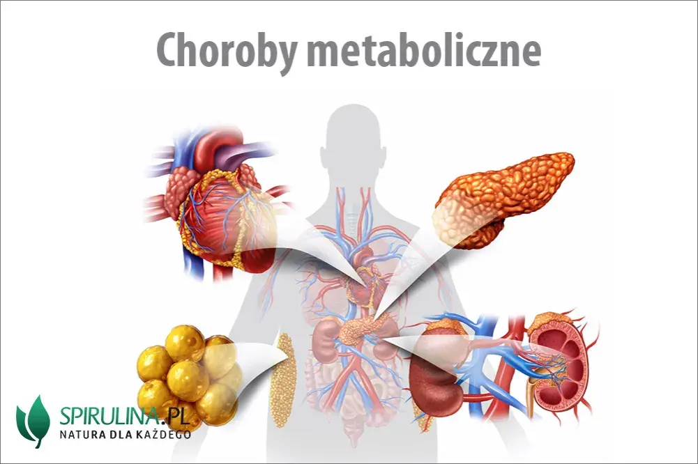 Zaburzenia metaboliczne: objawy, przyczyny i leczenie. Sprawdź, co jeść!