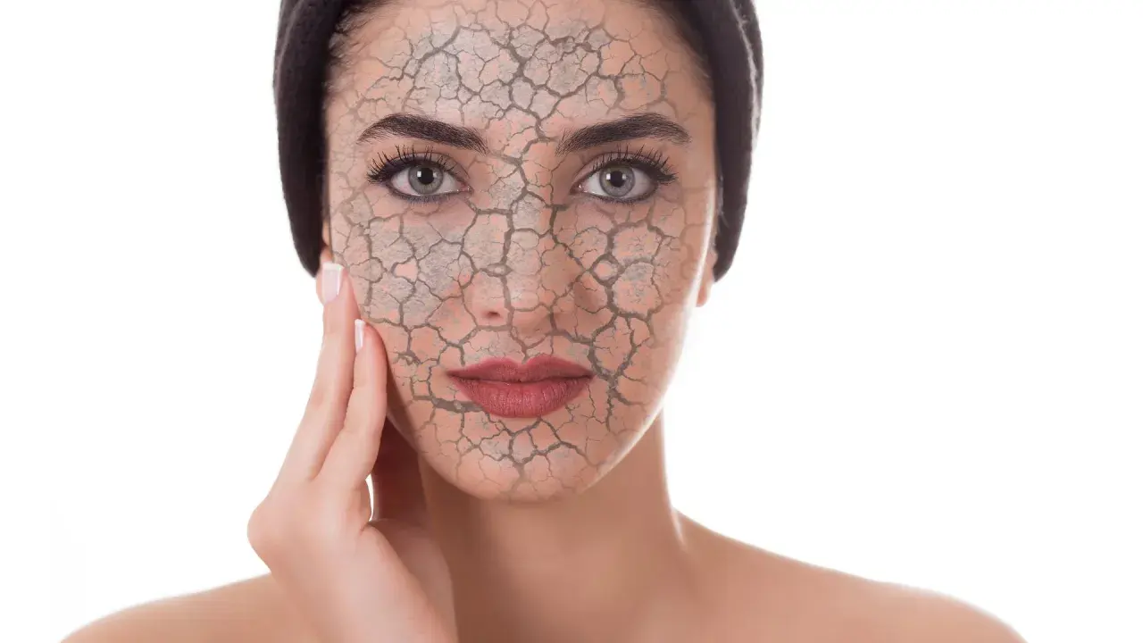 Rostro de mujer con piel agrietada, simulando el daño del estrés oxidativo.