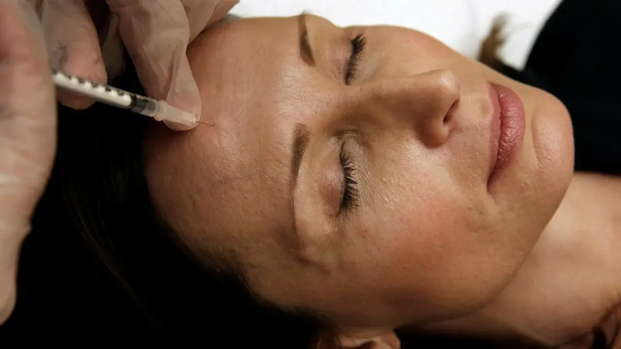 En hand i handske ger en injektion med en spruta i en kvinnas panna. Detta är en del av en behandling med botox på recept.