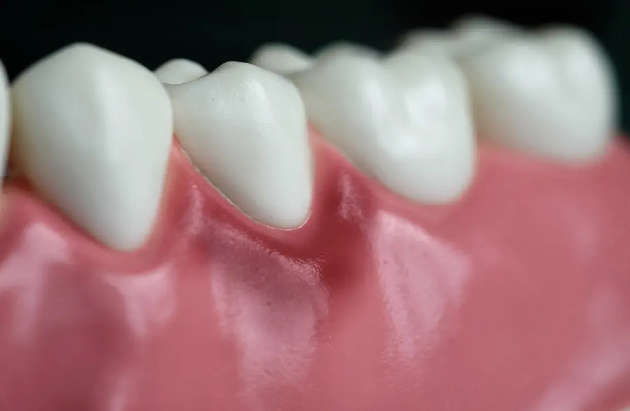 Detalle de dientes blancos y una encía roja en un diente, mostrando la línea de la encía.