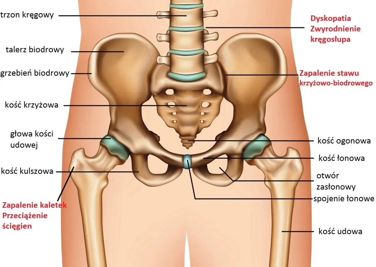 Anatomia miednicy i stawów biodrowych z zaznaczonymi strukturami kostnymi i schorzeniami.