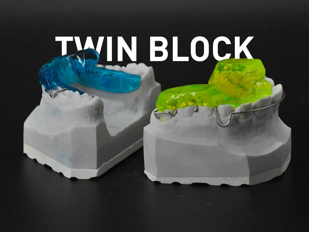Modelli dentali con apparecchi **twin block ortodonzia** blu e gialli, pronti per correggere la malocclusione.