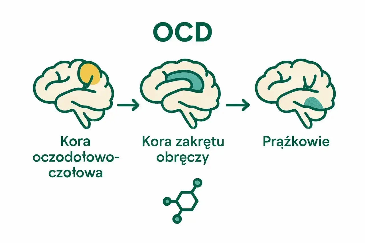 Schemat wyjaśnia, ocd co to: zmiany w korze oczodołowo-czołowej, zakrętu obręczy i jądrach prążkowia mózgu.