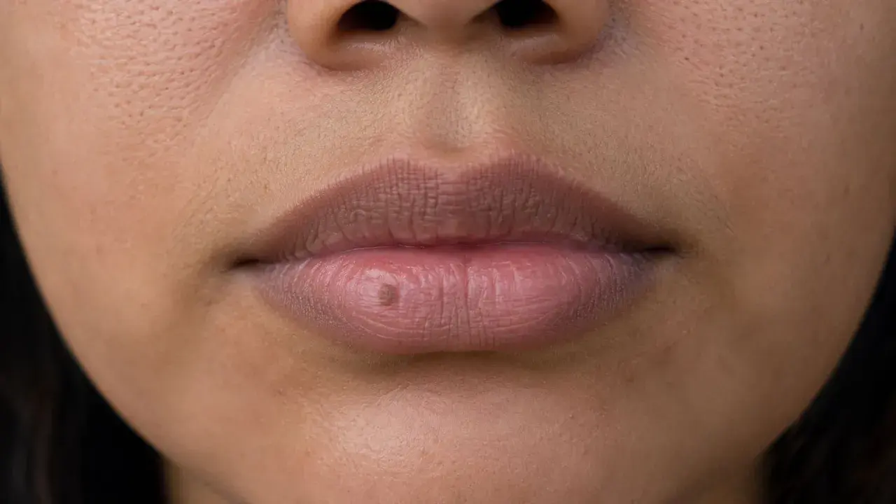 Un pequeño lunar en el labio inferior, como si hubiera aparecido de repente.