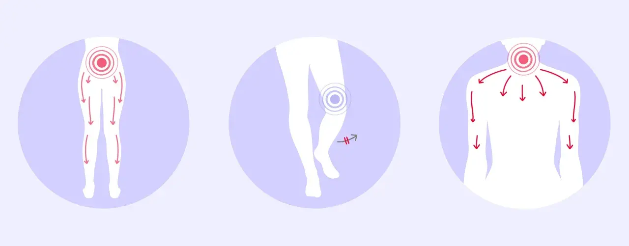 Schmerzhafte Ausstrahlung in Beine und Arme, Knie- und Nackenbeschwerden – typische spinalkanalstenose symptome.