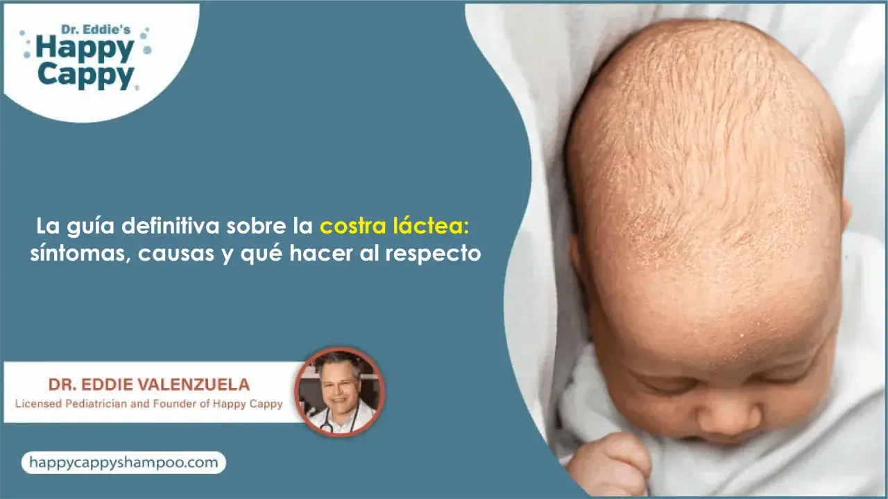 Bebé con costra láctea. Guía definitiva sobre síntomas, causas y tratamiento de la costra láctea. Dr. Eddie Valenzuela.