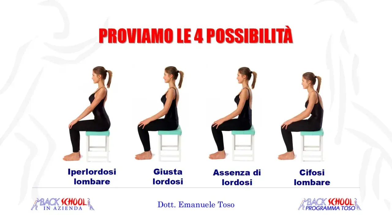 Quattro posture a confronto: iperlordosi lombare, lordosi corretta, assenza di lordosi e cifosi lombare. Utile per esercizi posturali.