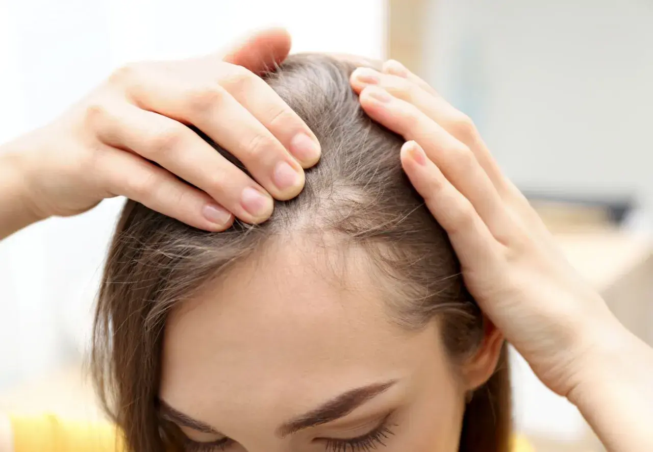 Manos revisando el cuero cabelludo, buscando señales de que el pelo pueda crecer.