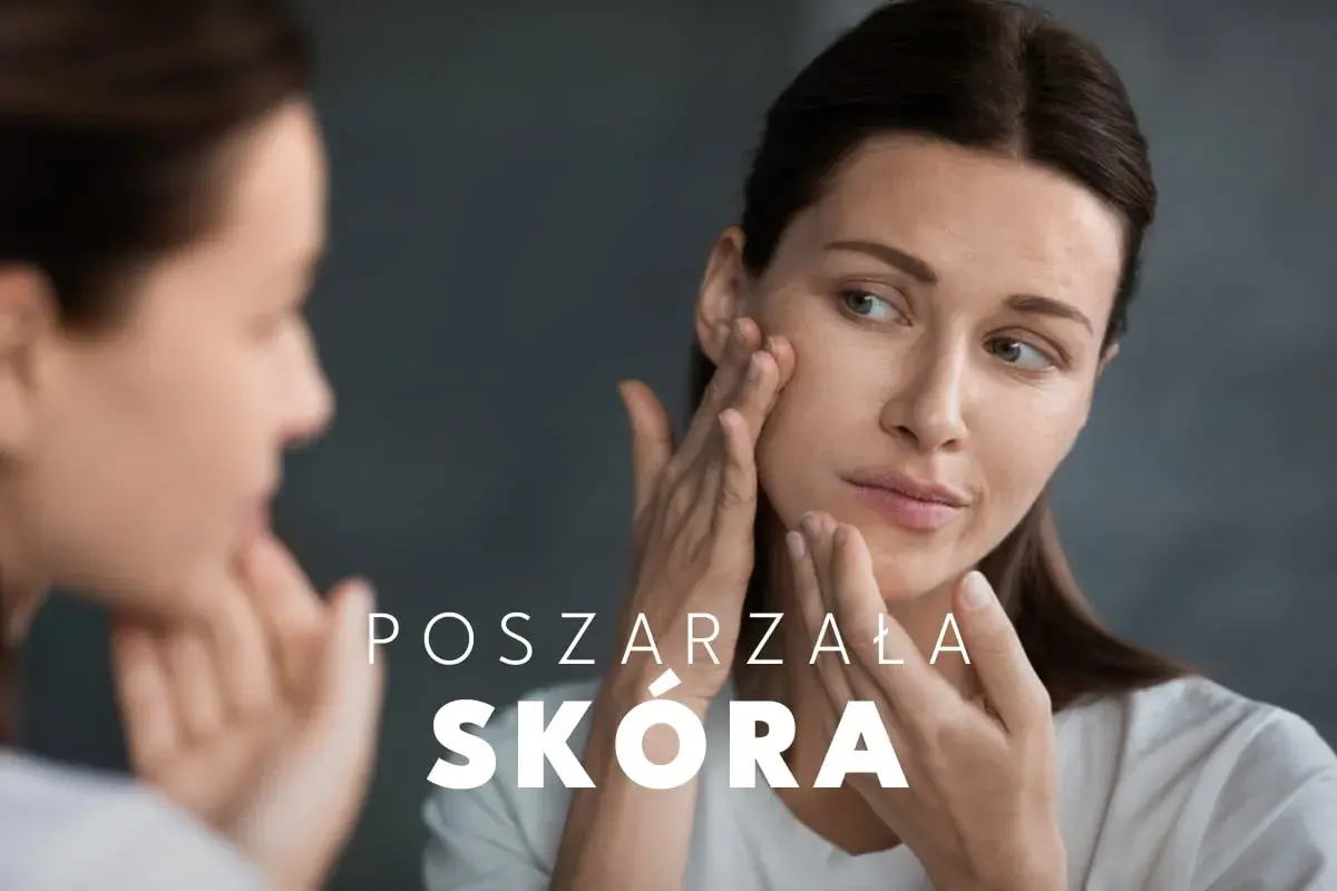 Kobieta z uwagą ogląda swoją poszarzałą cerę w lustrze, dotykając policzka.