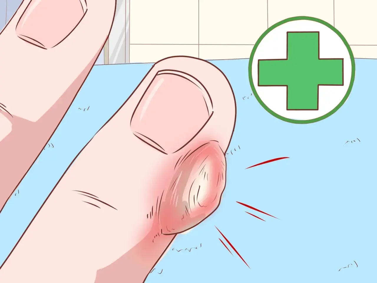 Gros plan d'un doigt enflammé avec une corne sur les mains, entouré d'un symbole médical vert.