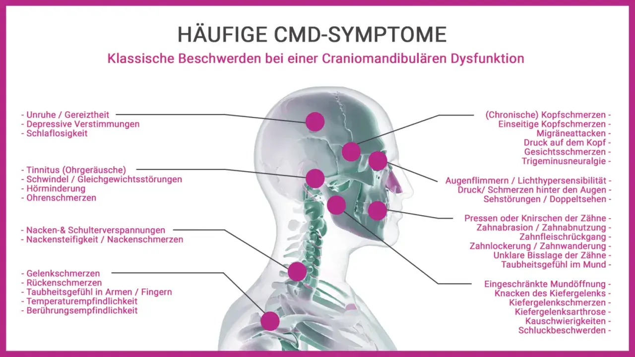 Kopfschmerzen Stirn, Migräne, Druckgefühl am Kopf und Gesichtsschmerzen sind häufige CMD-Symptome.