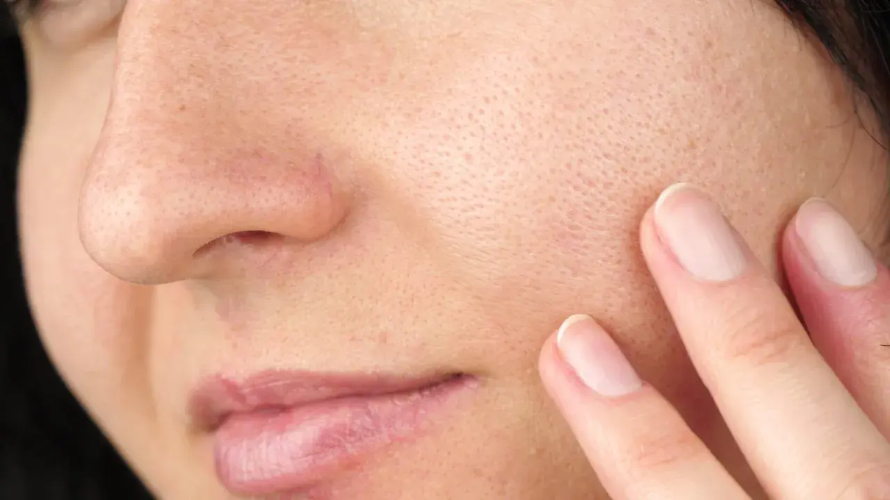 Gros plan sur une peau avec des pores visibles. Une main effleure la joue, suggérant une recherche de solutions pour comment enlever l'excès de sebum visage naturellement.