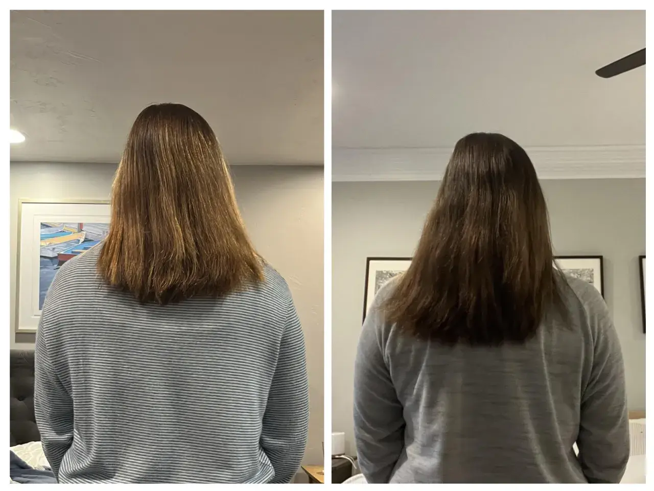 Due immagini affiancate mostrano i capelli di una persona, che sembrano non crescere.