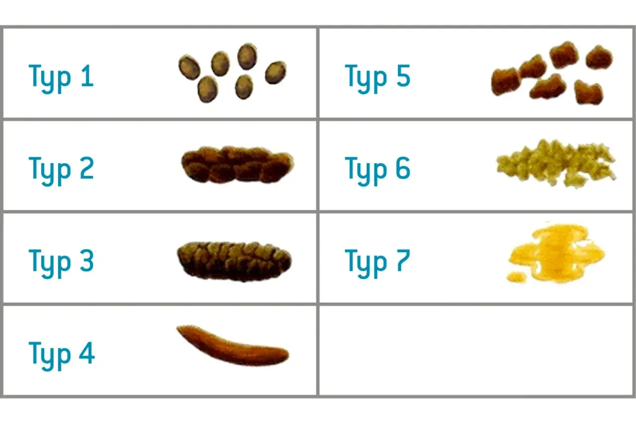 Classificazione delle scorie alimentari: da grumi separati a feci liquide, ogni tipo indica qualcosa.