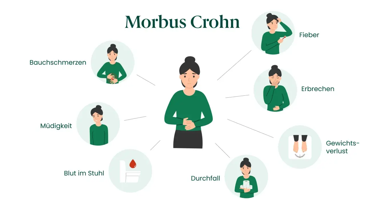 Illustration zeigt typische Morbus Crohn Symptome bei einer Frau: Bauchschmerzen, Müdigkeit, Blut im Stuhl, Durchfall, Fieber, Erbrechen, Gewichtsverlust.