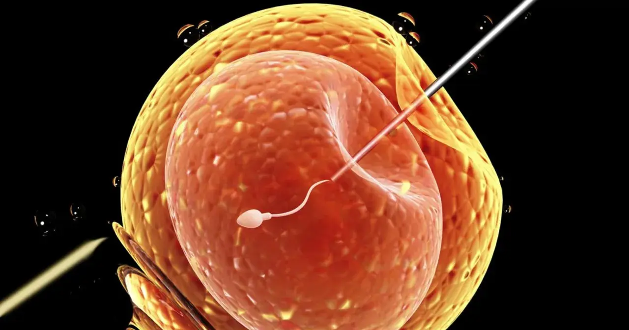 Sperm wstrzykiwany do komórki jajowej, proces wspomagany przez Ovitrelle.