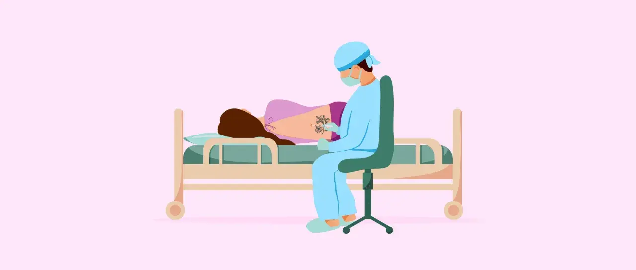 Médico administra epidural a paciente con tatuajes en la espalda.