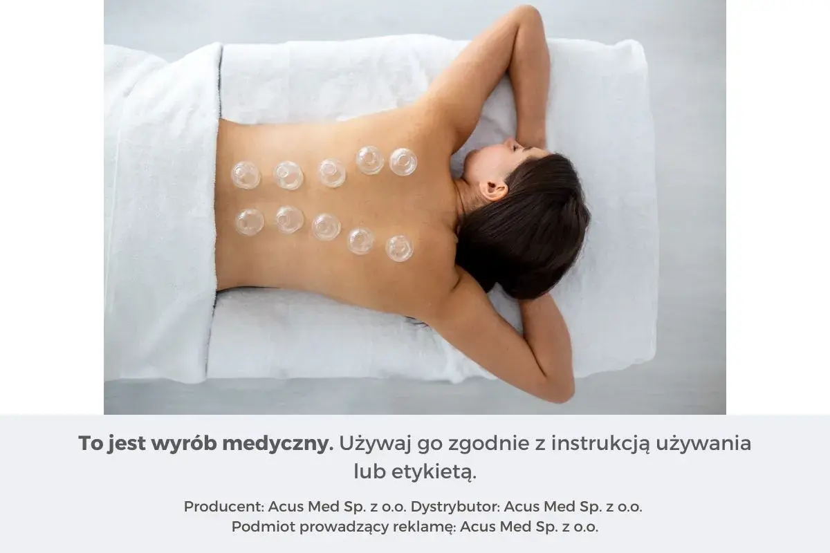 Kobieta z bańkami na plecach, stosowanymi jako metoda wspomagająca leczenie kaszlu.