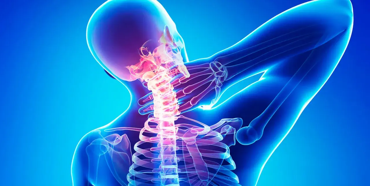 Menschlicher Nacken mit leuchtender Wirbelsäule, die auf Osteochondrosis intervertebralis hinweist.