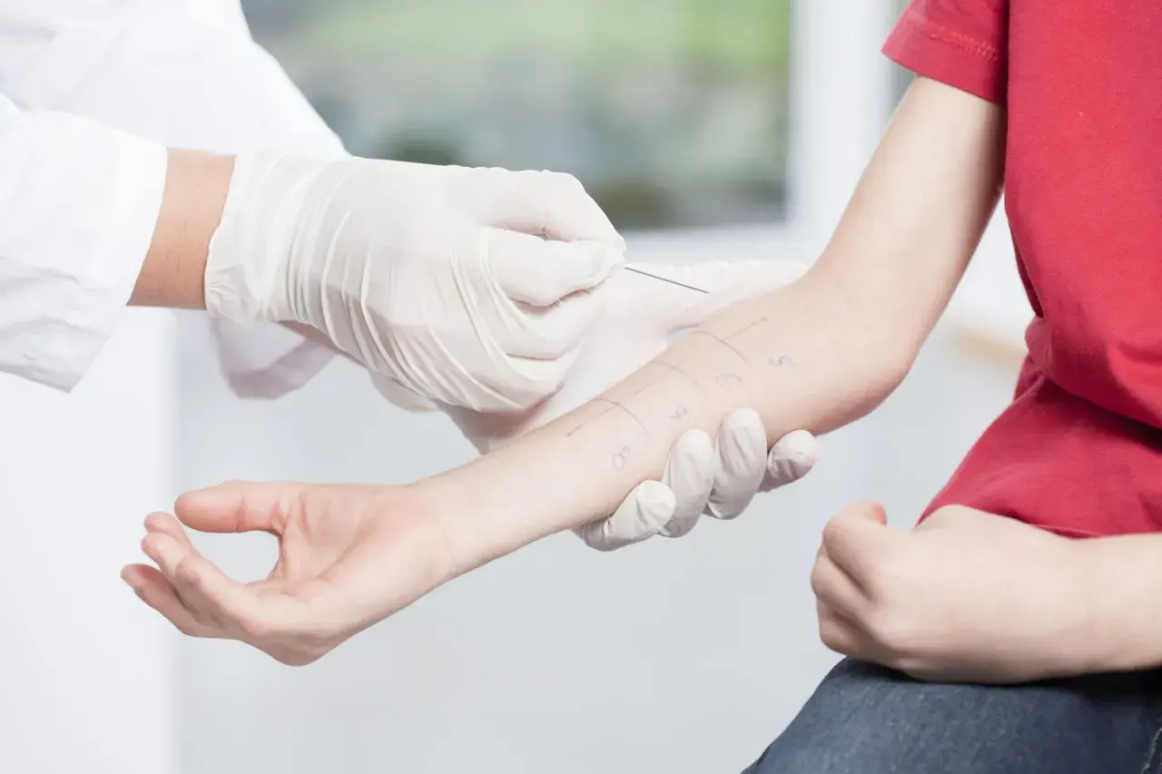 Uczulenie na przyprawy objawy – jak rozpoznać niebezpieczne symptomy