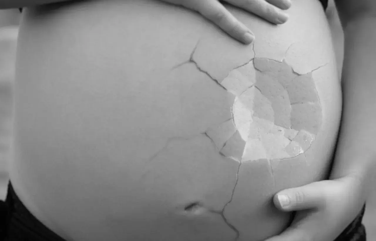 En gravid mage med sprickor som ett äggskal. En symbol för ett missfall vecka 16.