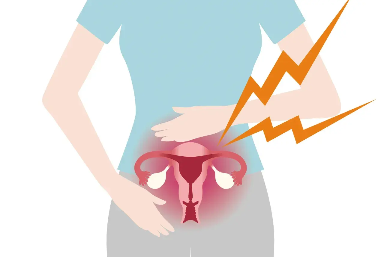 Illustration av en gravid kvinna som håller sig om magen. Hon upplever ilningar i underlivet, symboliserat av blixtar.