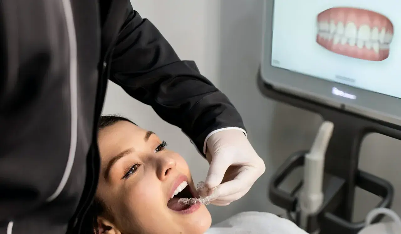 Dentysta pomaga pacjentce z kruche zęby jak wzmocnić, zakładając jej przezroczysty aparat ortodontyczny. Na ekranie widać wizualizację uzębienia.