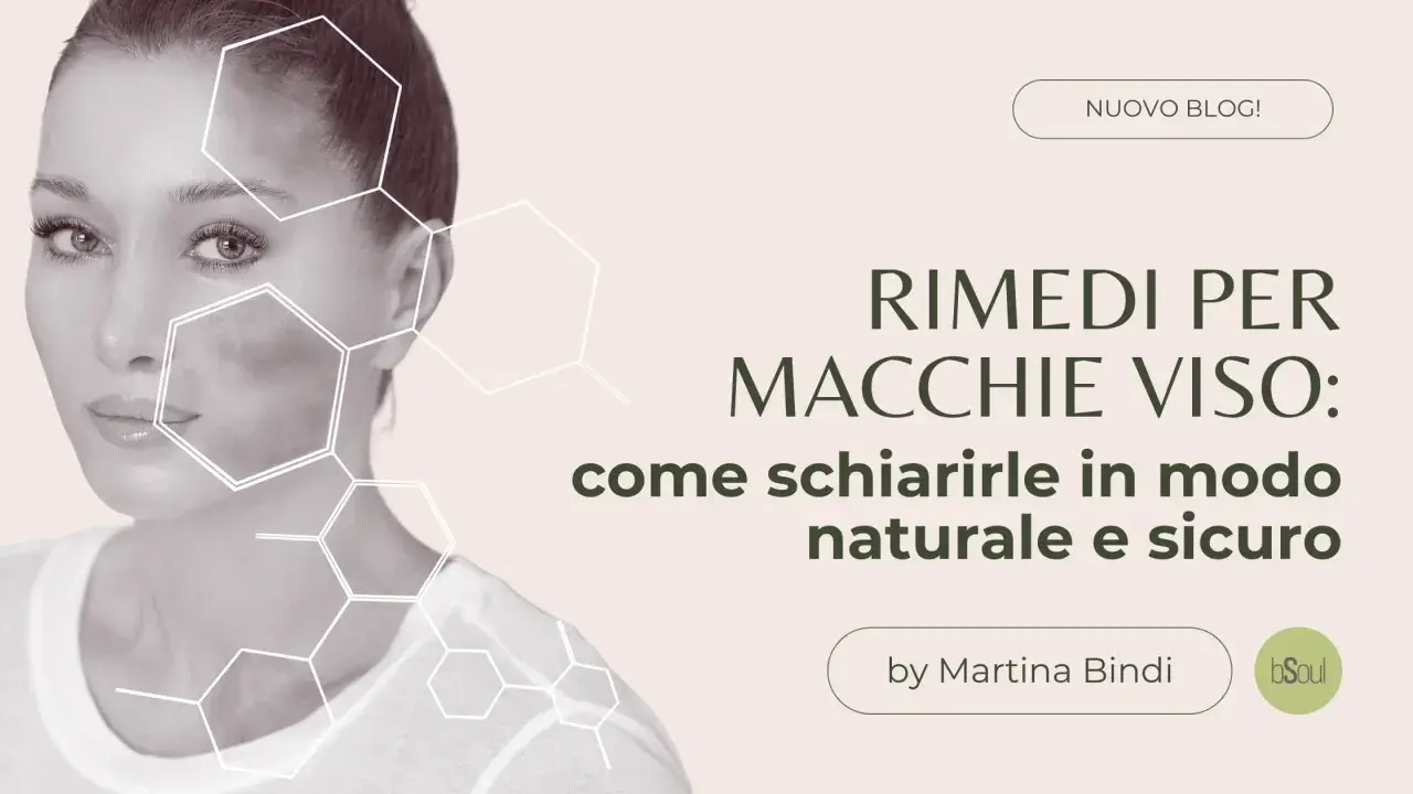 Donna con macchie sul viso, con grafiche esagonali. Titolo: "Rimedi per macchie viso: come coprire le macchie sul viso in modo naturale e sicuro".