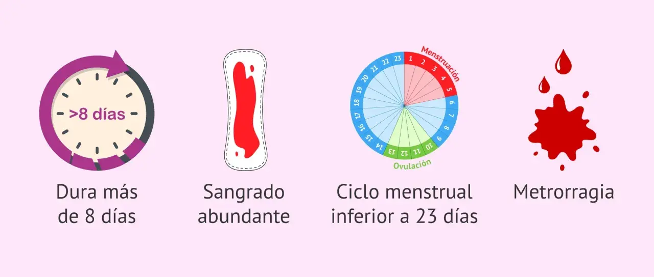 Ilustración de síntomas de la regla: duración >8 días, sangrado abundante, ciclo corto (<23 días) y metrorragia.